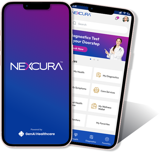 Nexcura mobile screen